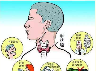 甲状腺结节,症状表现,心脏病,治疗率