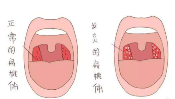 重庆仁品耳鼻喉医院推荐