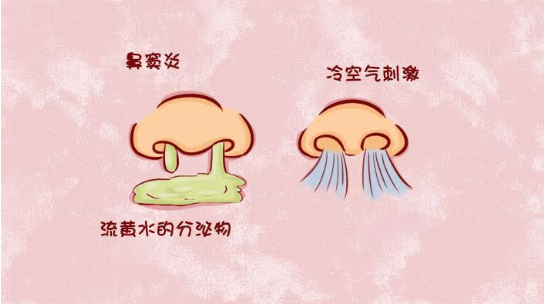 鼻窦炎和鼻炎有哪些区别