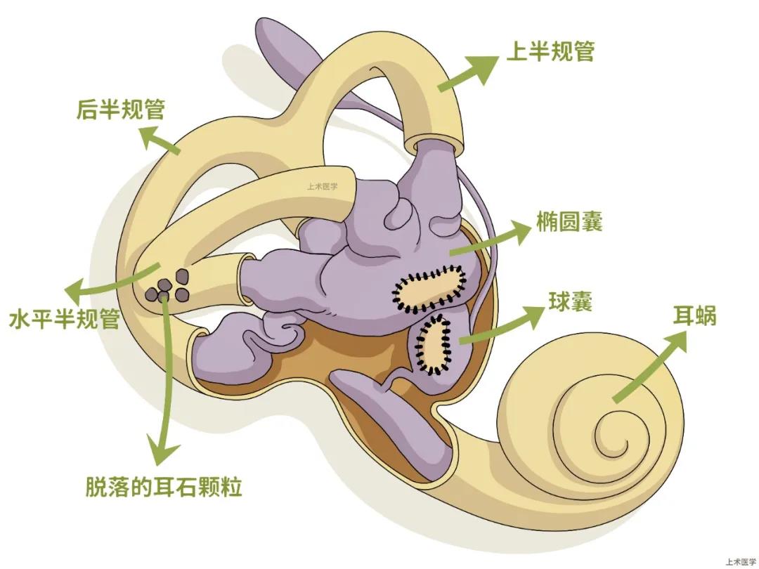 耳石症