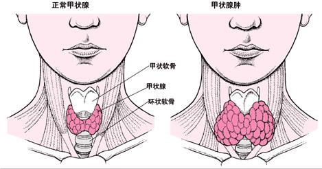 甲状腺