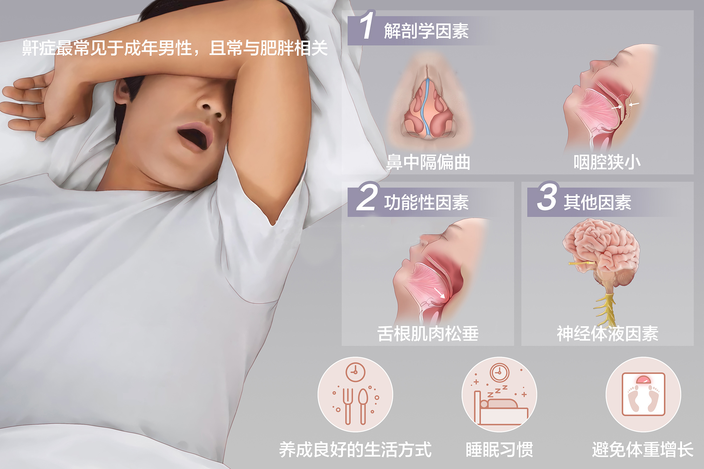 重庆看打鼾医院