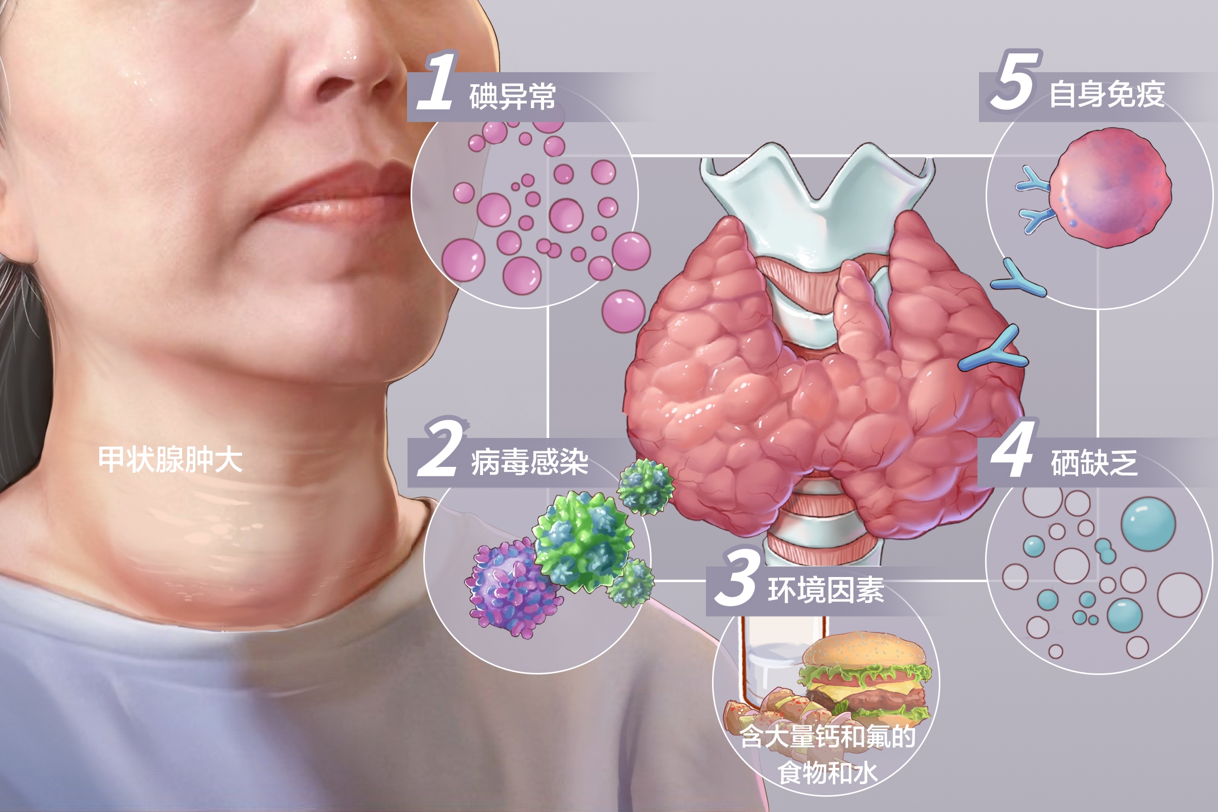 重庆治疗甲状腺肿大医院