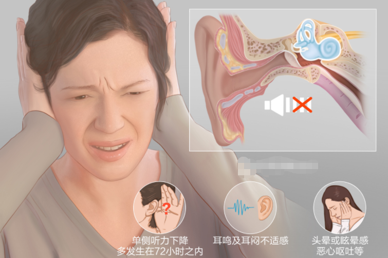 突发性耳聋的治疗方法