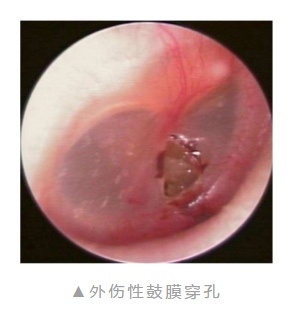 重庆仁品耳鼻喉医院靠谱吗