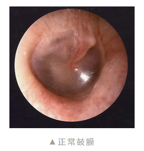 重庆鼓膜穿孔医院
