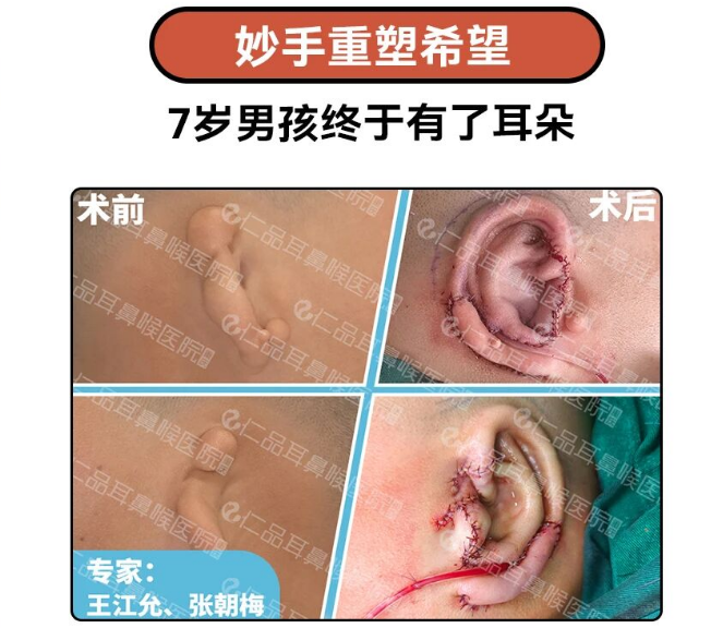 重庆耳鼻喉专科医院哪家好？