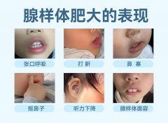 重庆耳鼻喉专科医院哪家好？