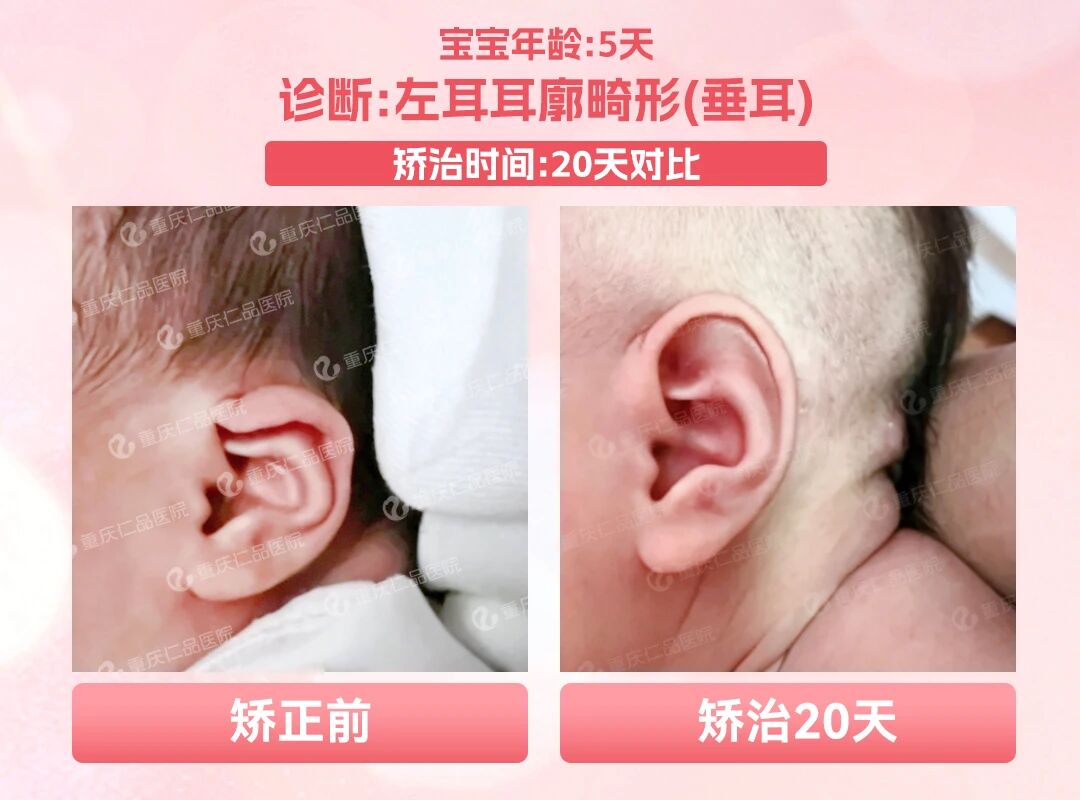 重庆耳鼻喉专科医院哪家好？